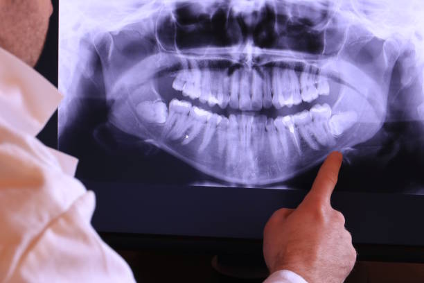Best Emergency Denture Repair in Glenrock, WY