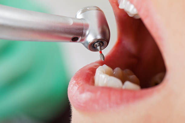 Best Emergency Pediatric Dental Care in Glenrock, WY